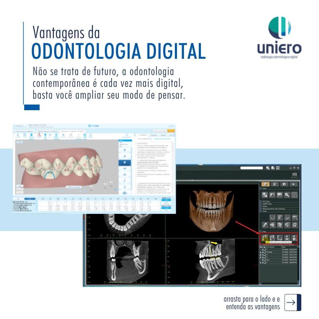 Exame digital com a visualização de arcada dentária