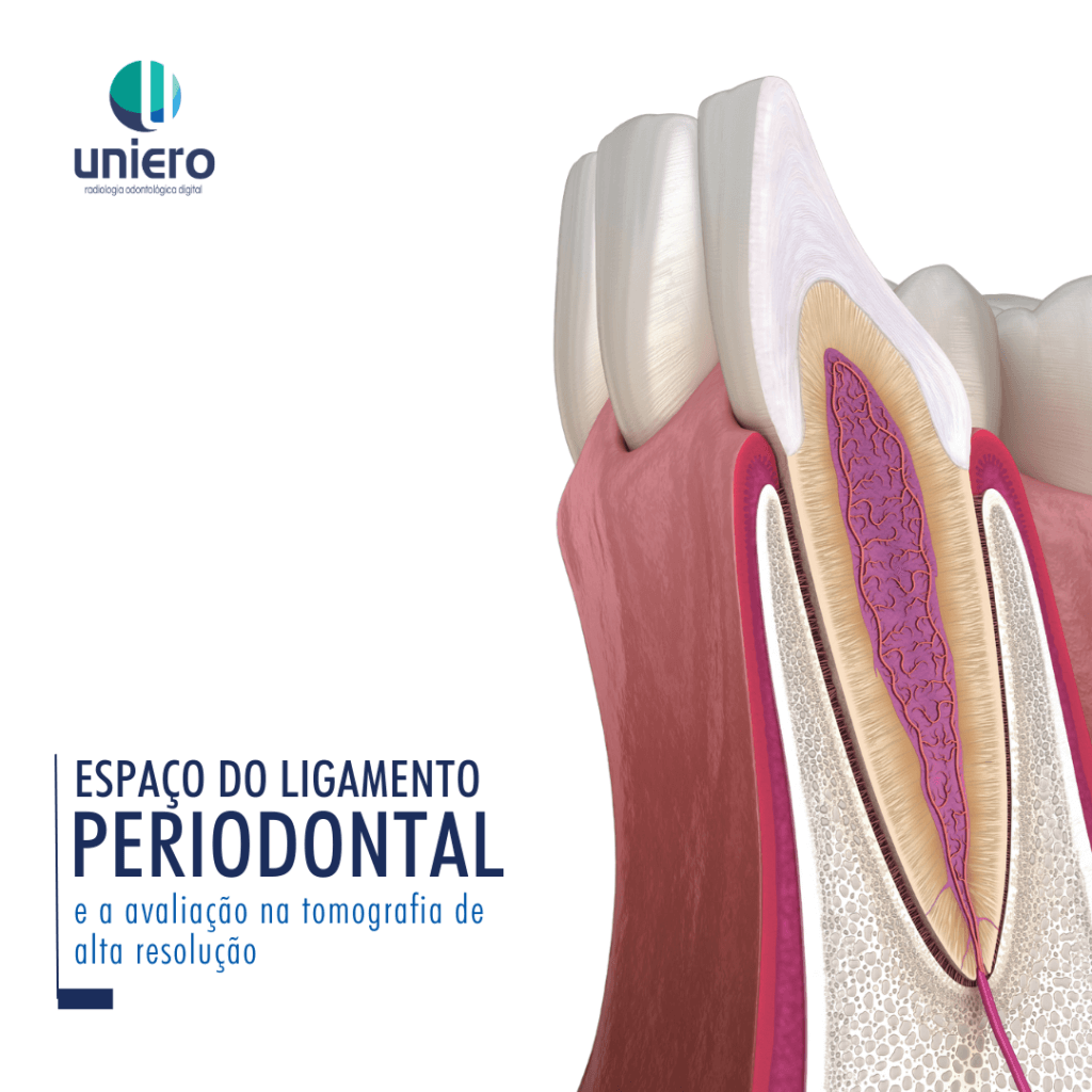 Representação de um espaço de ligamento periodontal