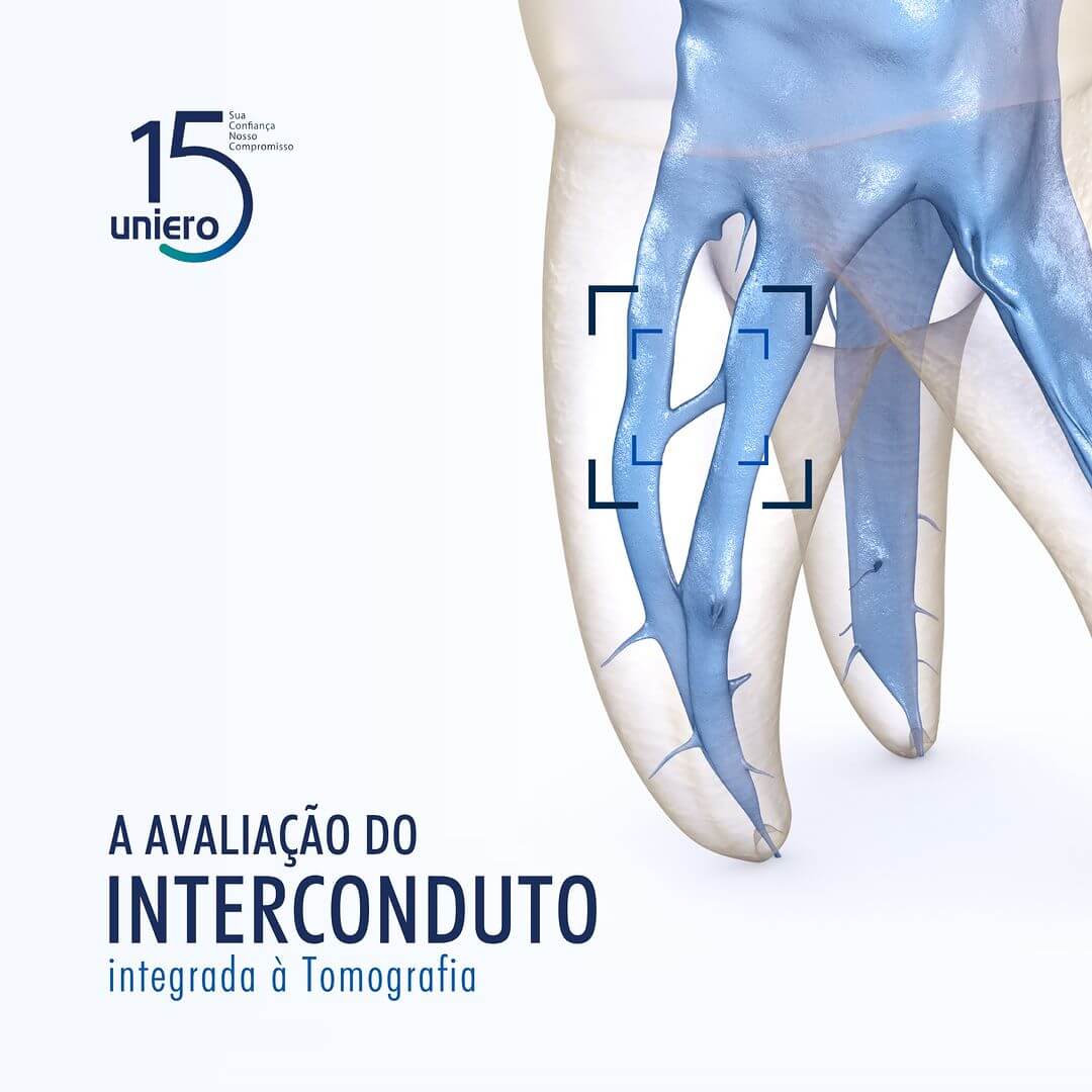 a-avaliacao-do-interconduto-integrada-a-tomografia