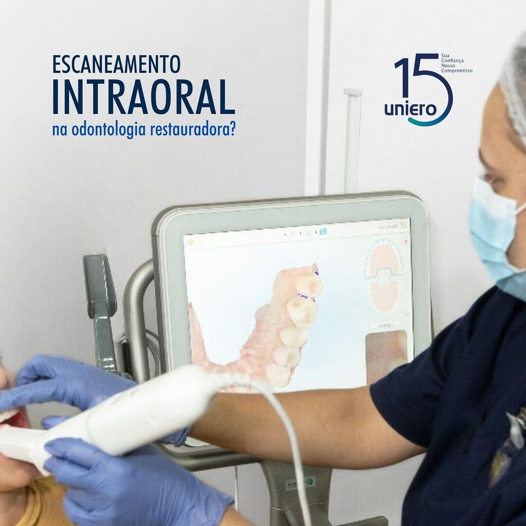 escaneamento-intraoral-na-odontologia-restauradora
