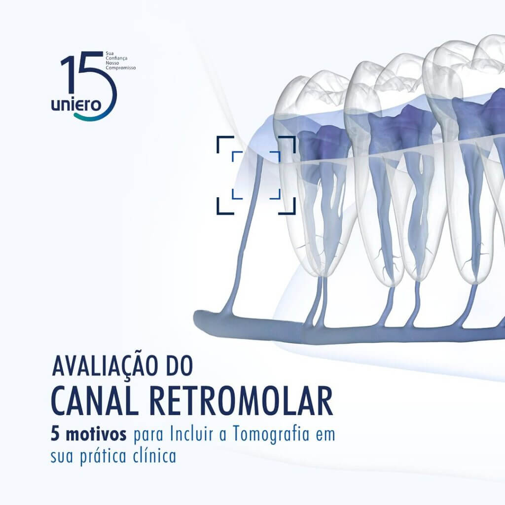 avaliacao-do-canal-retromolar