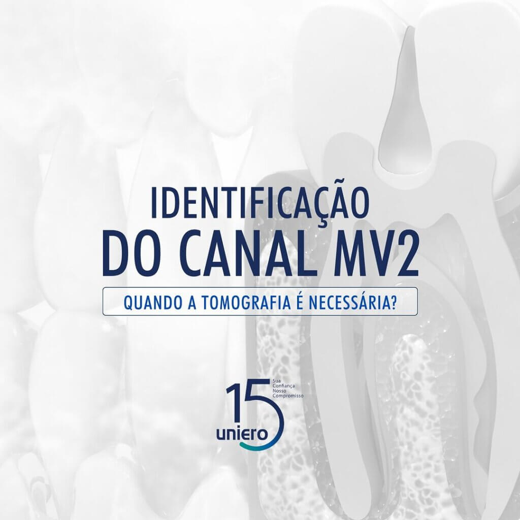 identificacao-do-canal-mv2