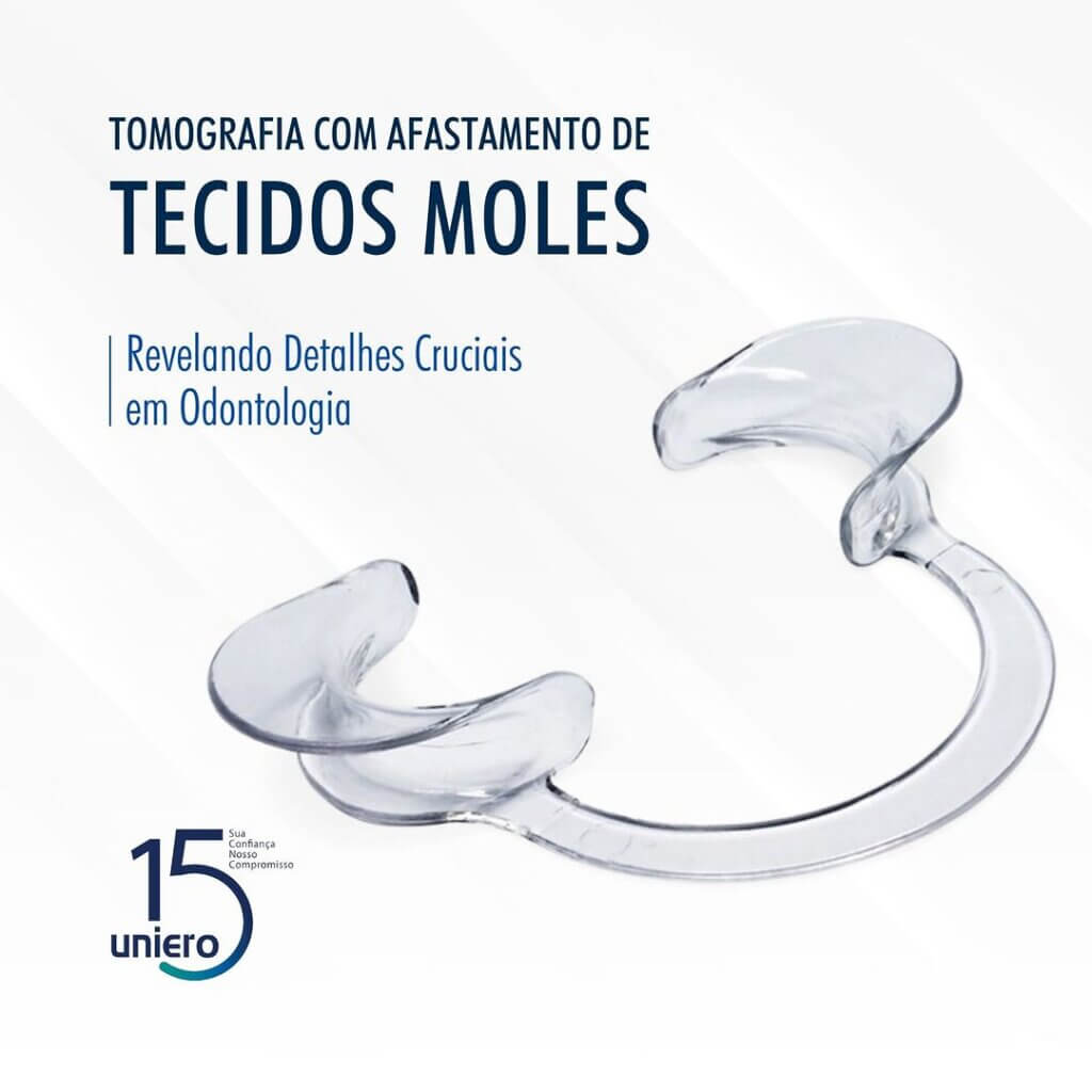 tomografia-com-afastamento-de-tecidos-moles