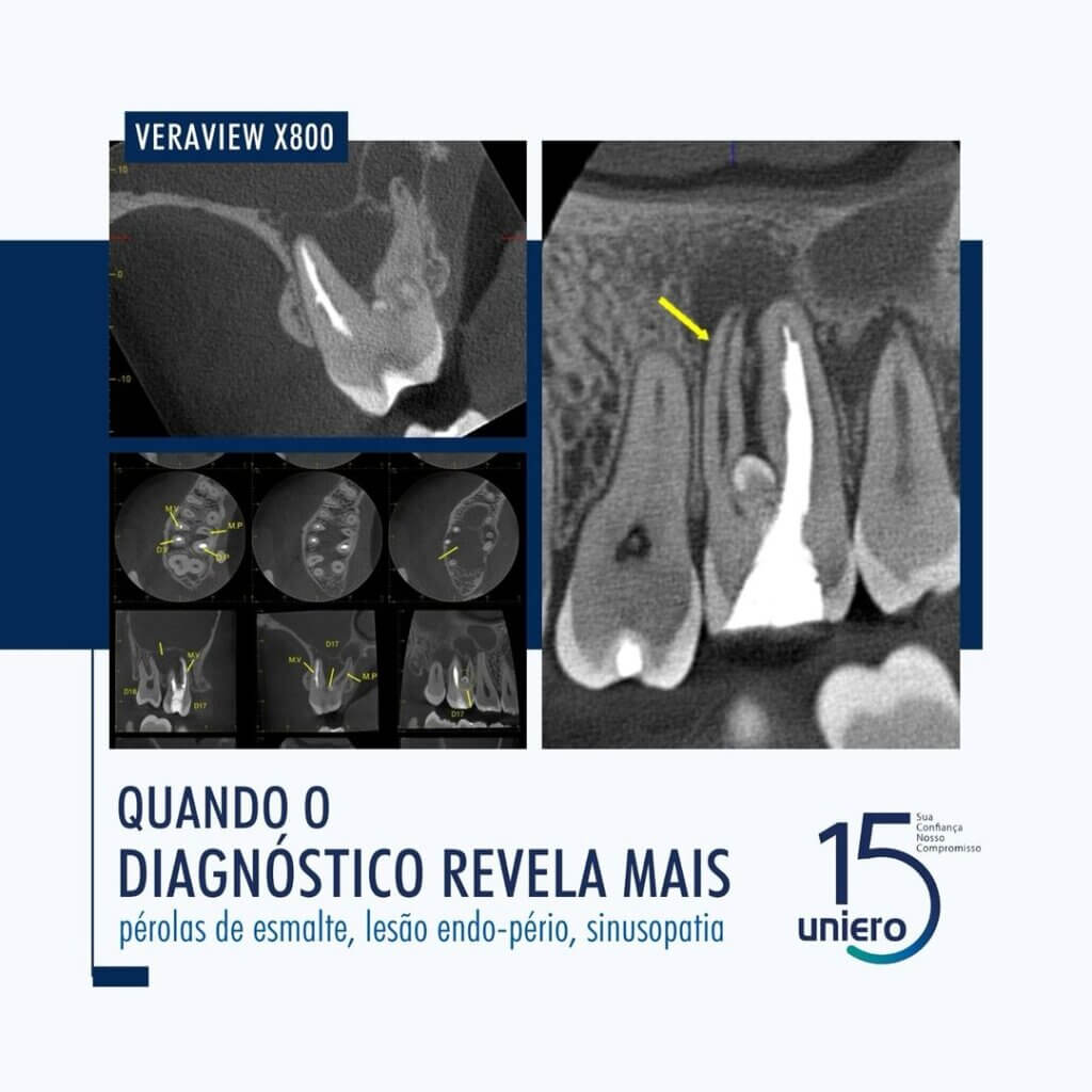 quando-o-diagnostico-revela-mais