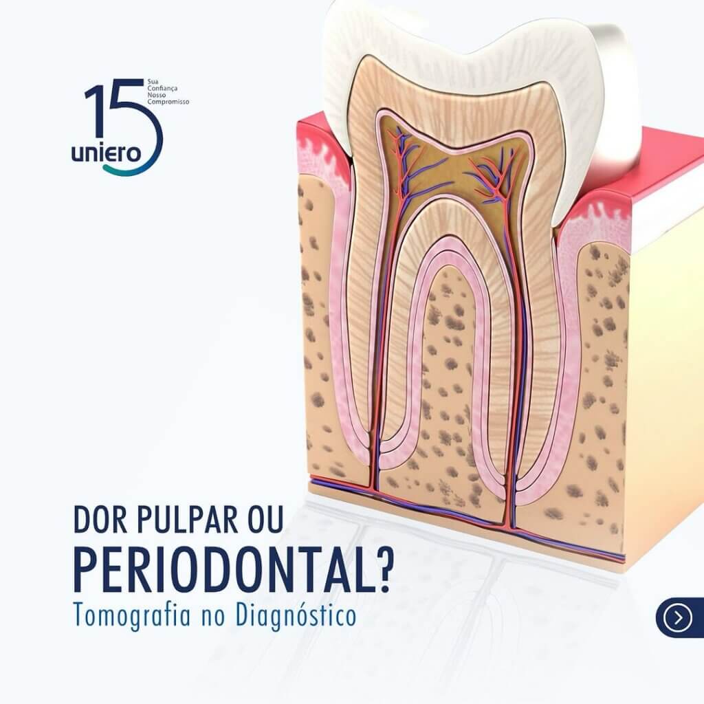 dor-pulpar-ou-periodontal
