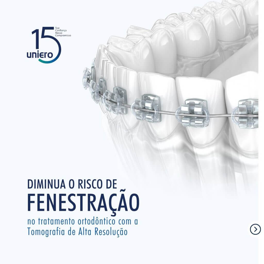 diminua-o-risco-de-fenestração