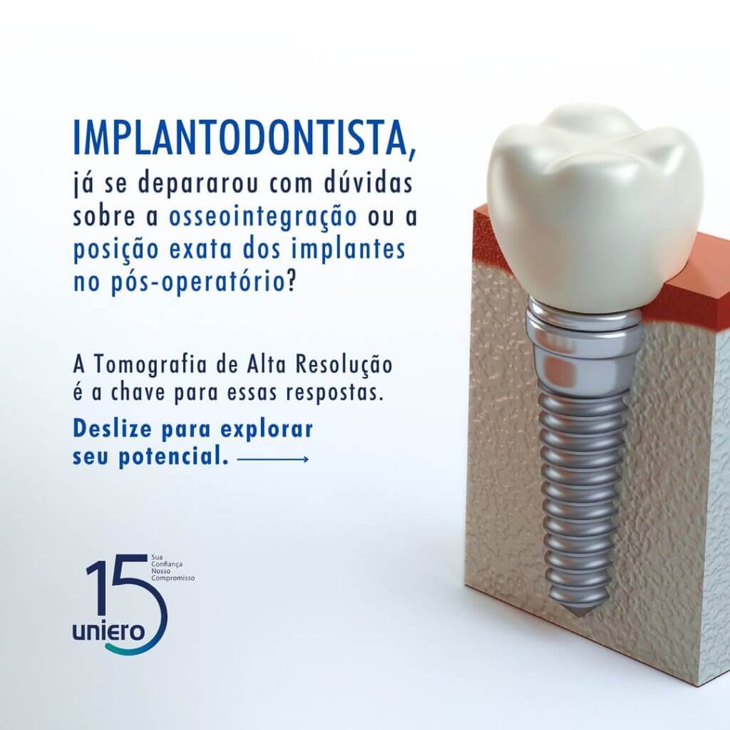 pos-operatorio-de-implantes