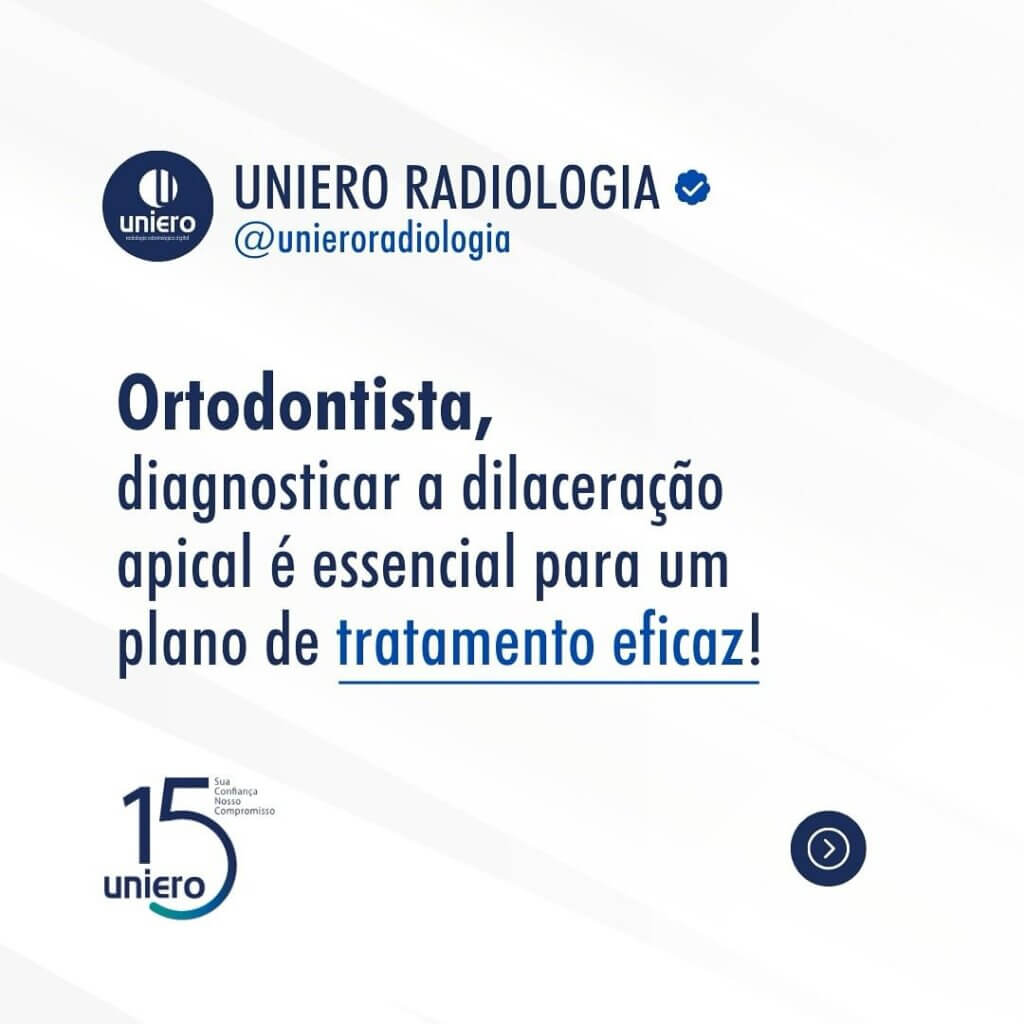 identificacao-precisa-de-dilaceracoes-apicais