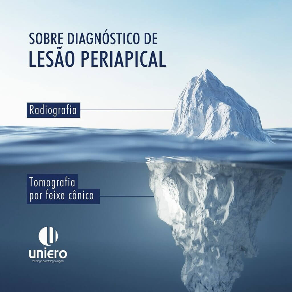 diagnostico-de-lesao-periapical
