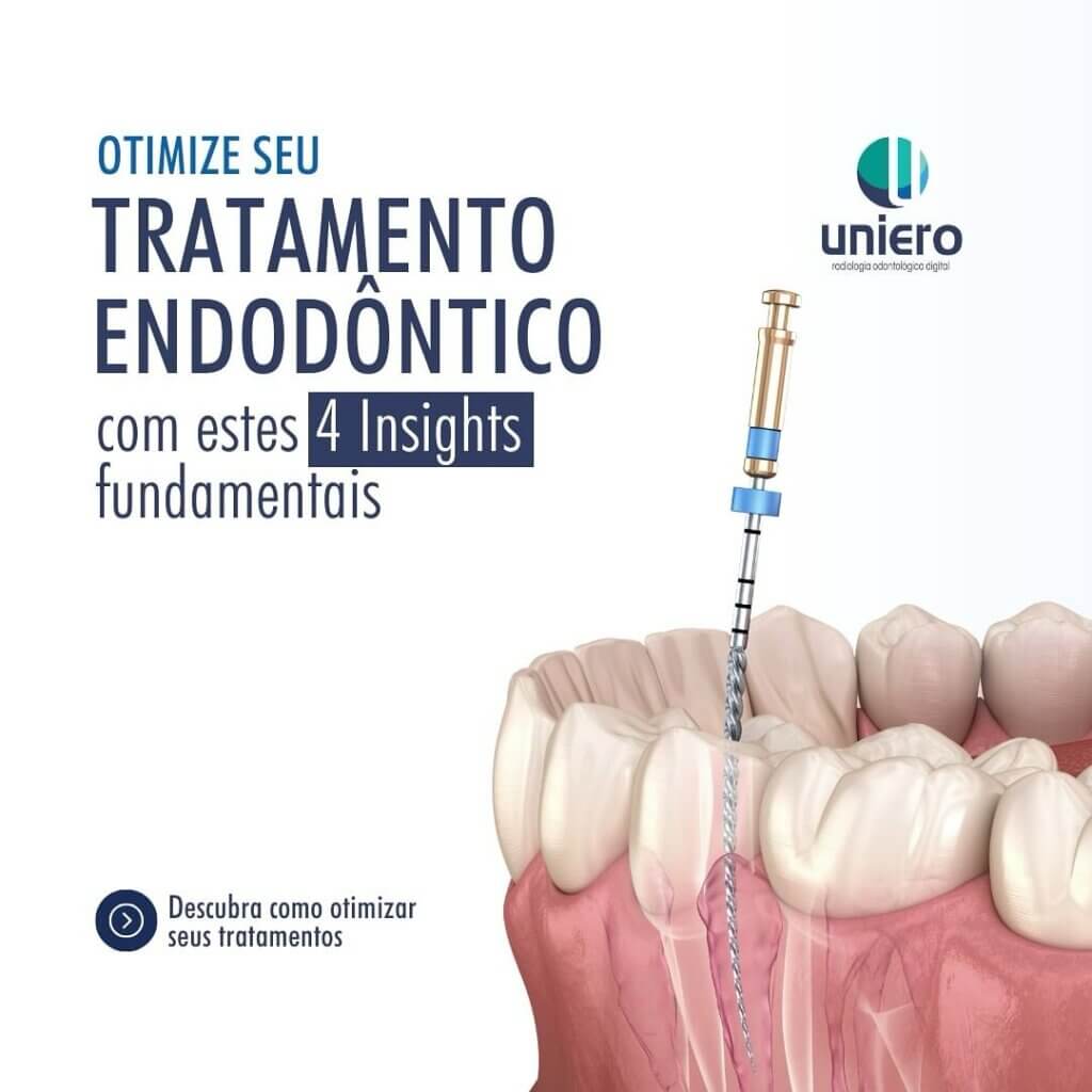 otimize-seu-tratamento-endodontico