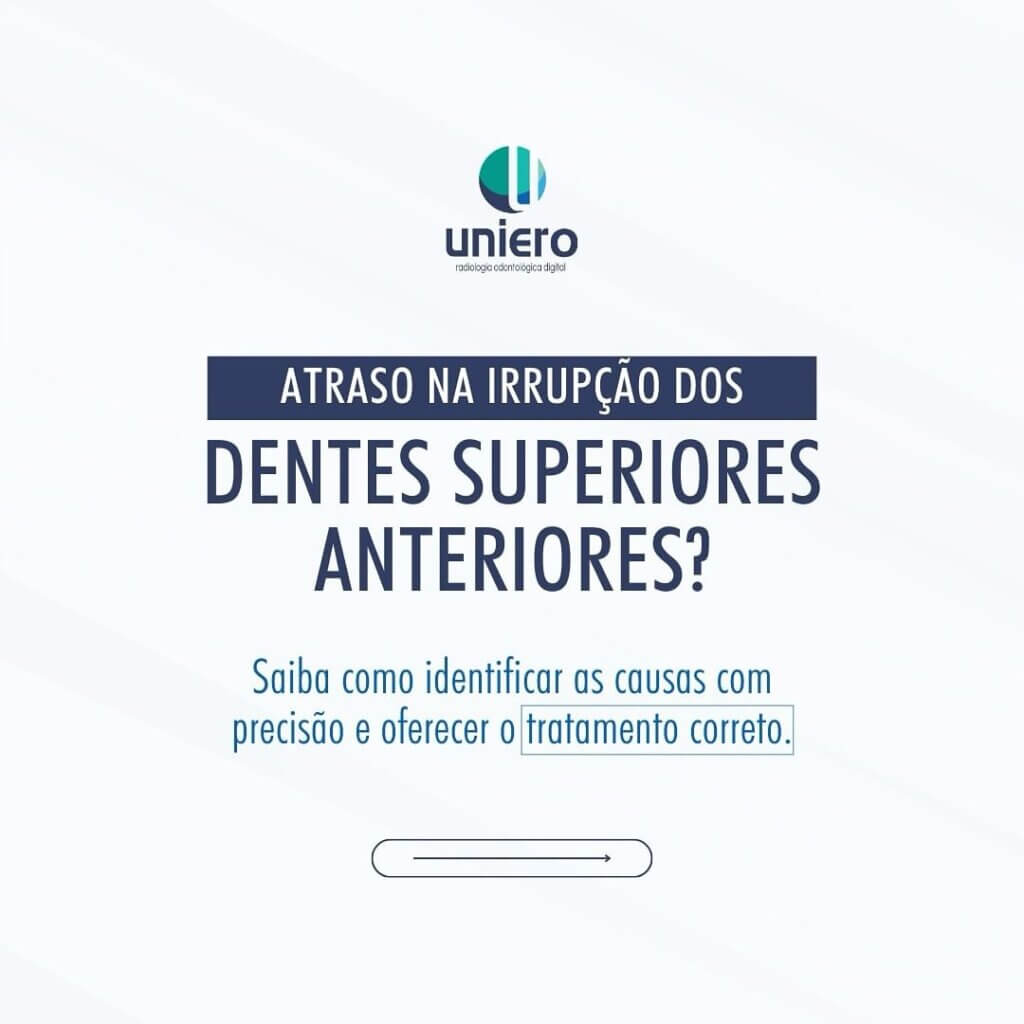 irrupcao-dos-dentes-superiores-anteriores