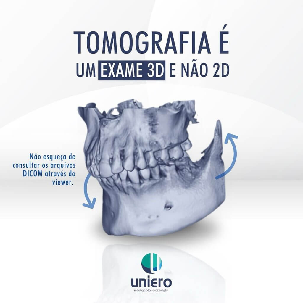 tomografia-e-um-exame-3d-e-nao-2d