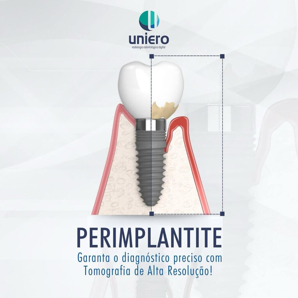 perimplantite