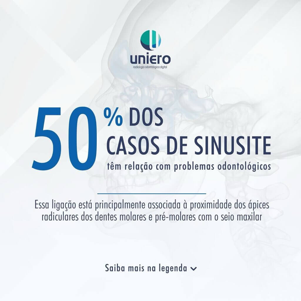 casos-de-sinusite