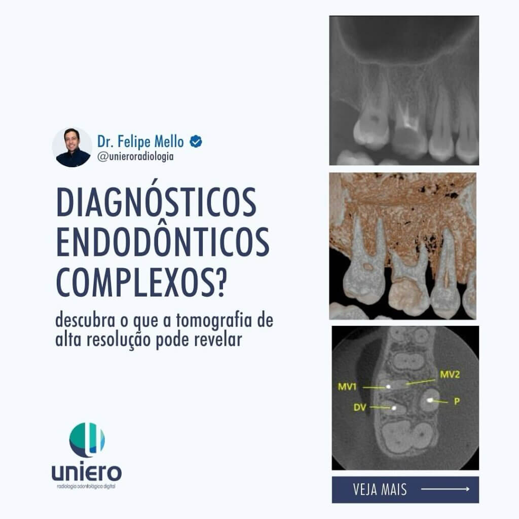 diagnosticos-endodonticos-complexos