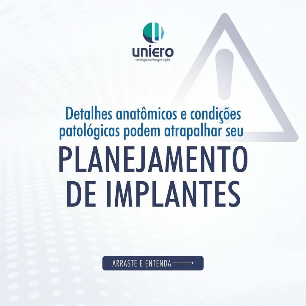 planejamento-de-implantes