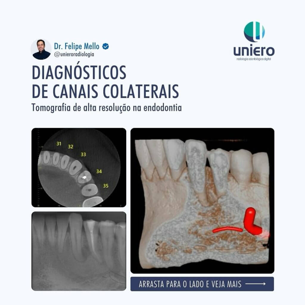 diagnosticos-de-canais-colaterais