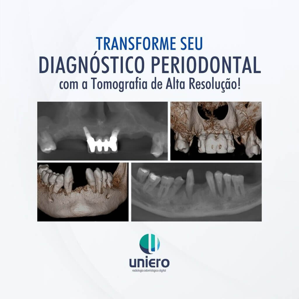 diagnostico-periodontal