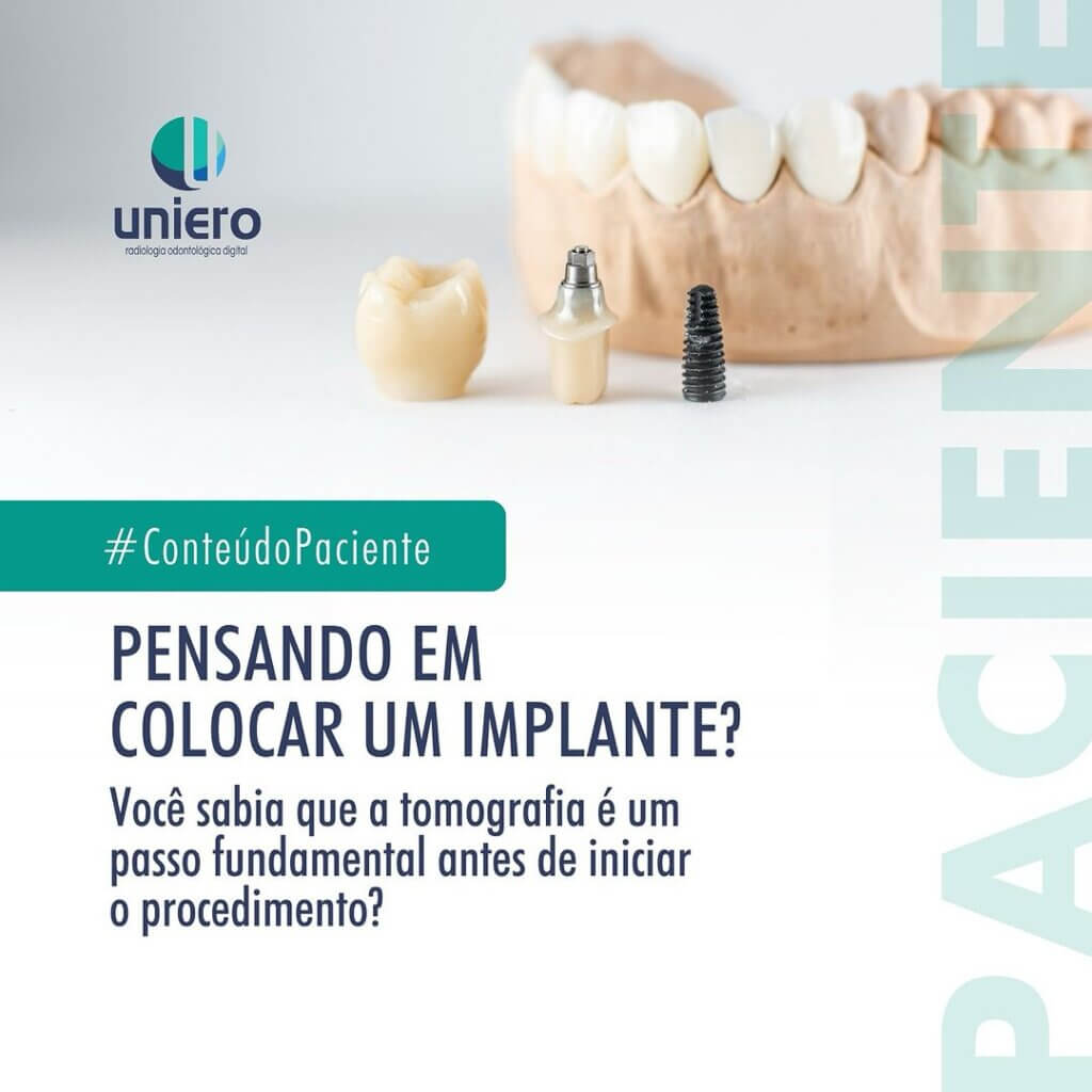 integracao-do-implante