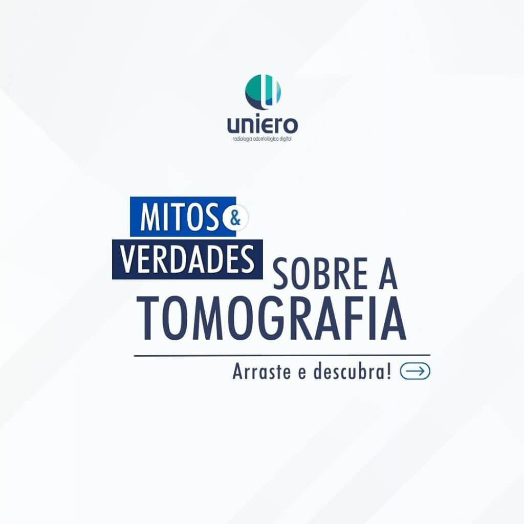 mitos-e-verdades-sobre-a-tomografia