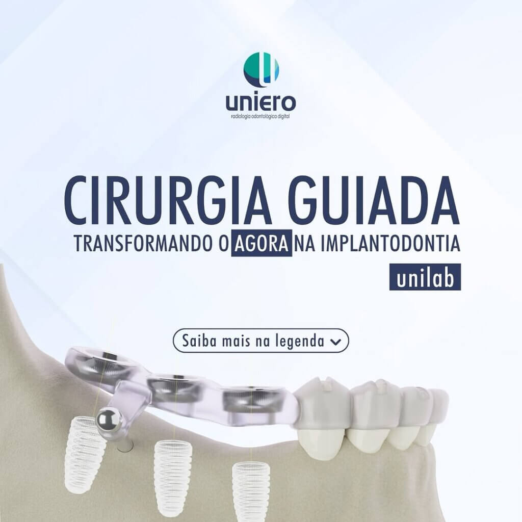 a-cirurgia-guiada