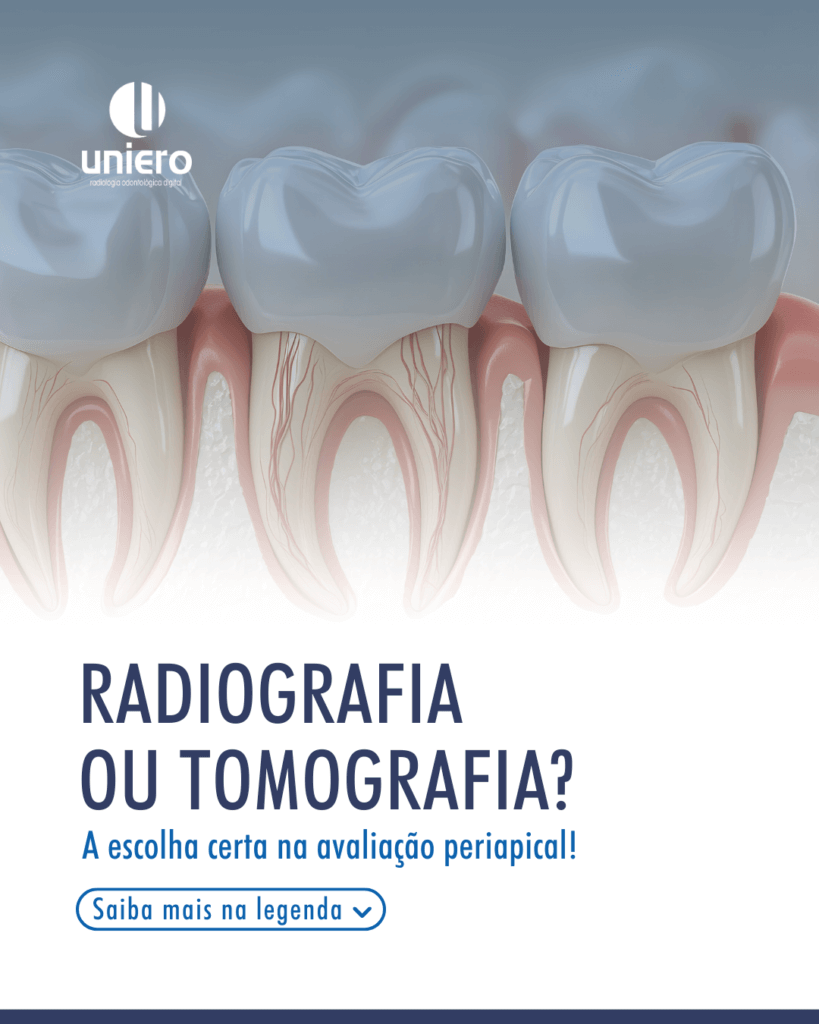 deteccao-precoce-das-lesoes-periapicais