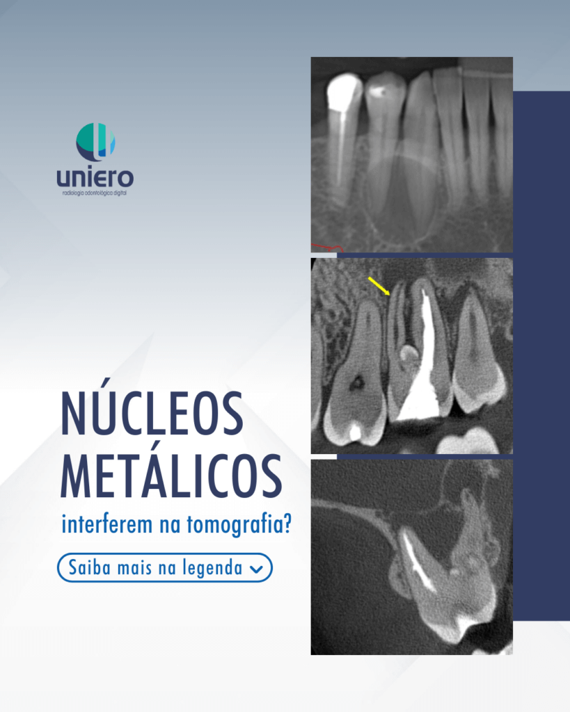 nucleos-metalicos