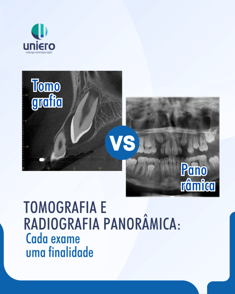 radiografia-panoramica-x-tomografia