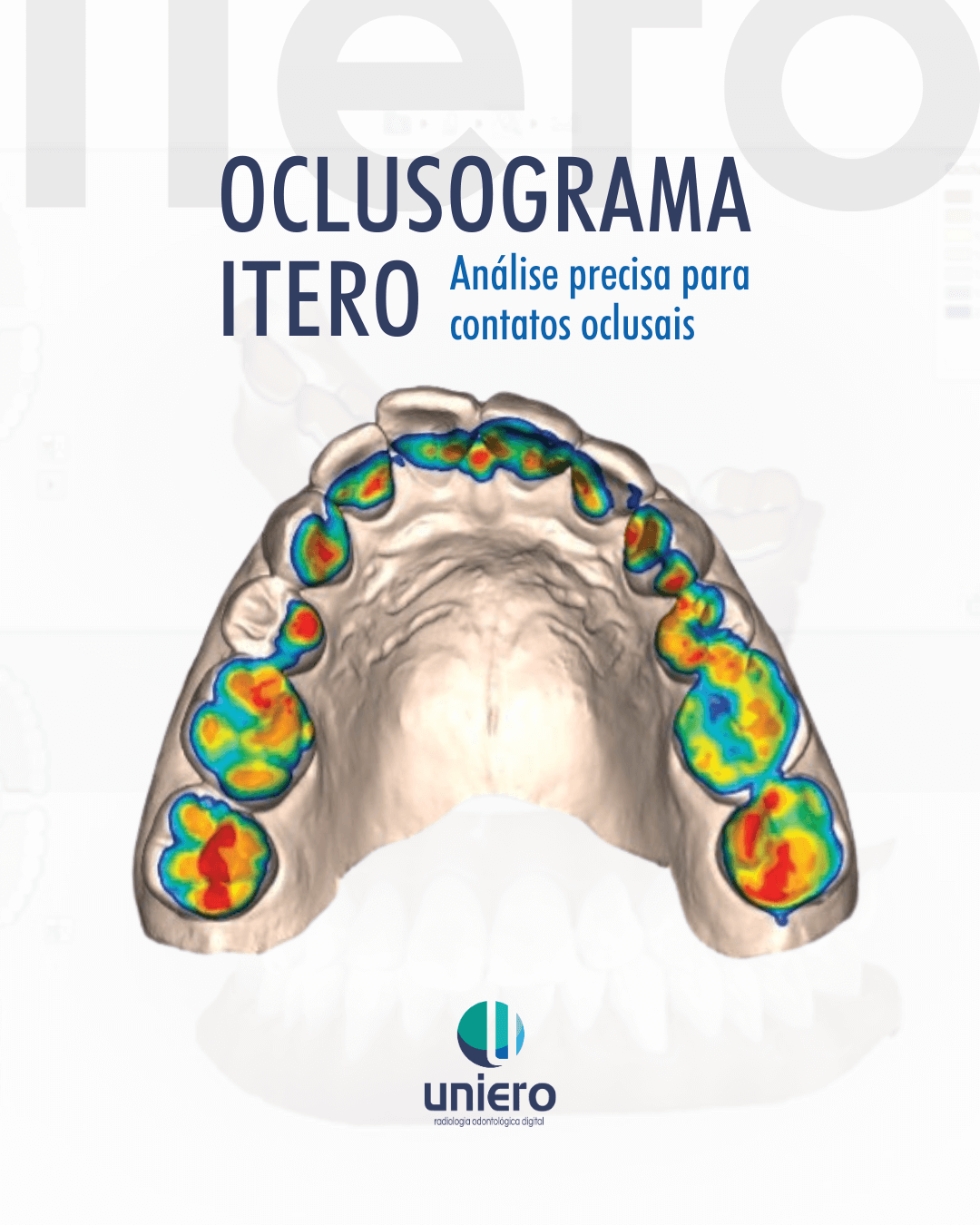 oclusograma-itero