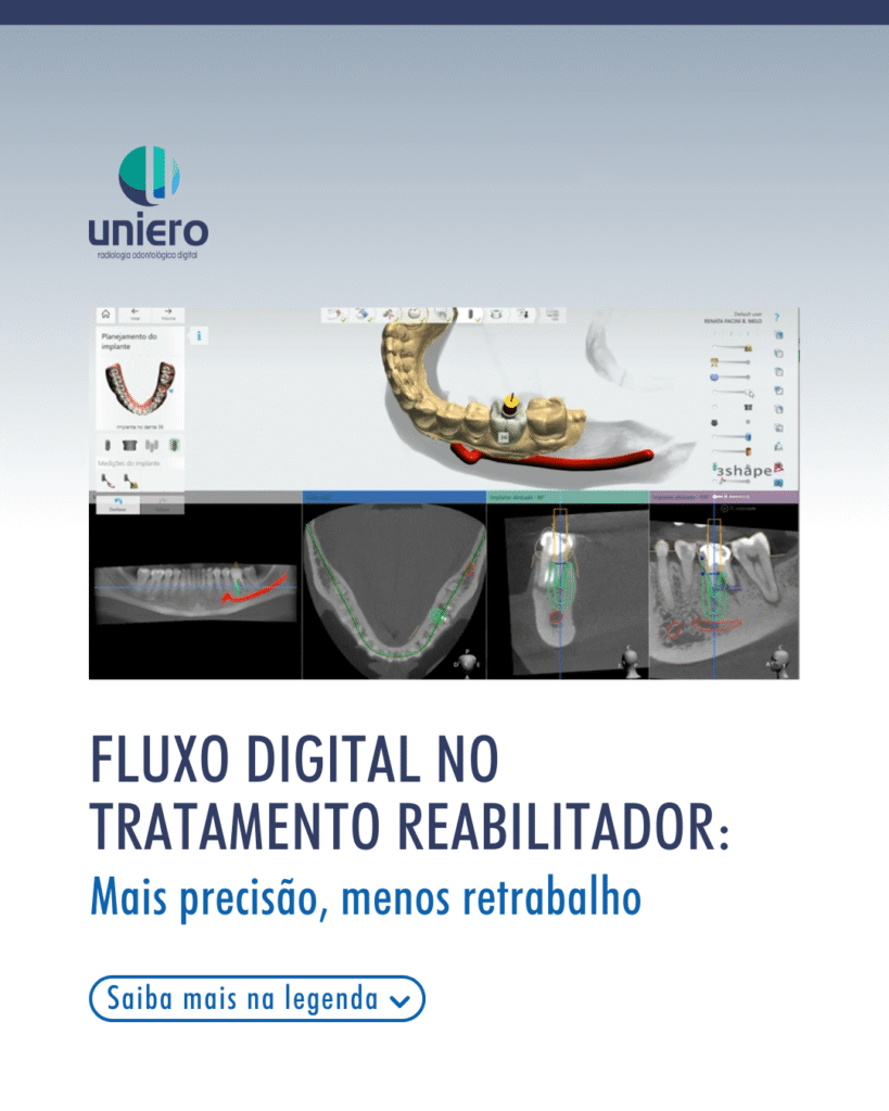 fluxo-digital-no-tratamento-reabilitador