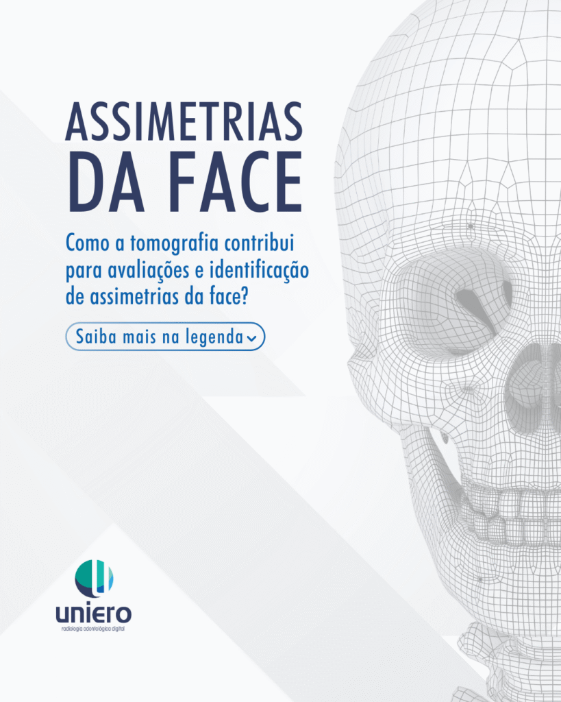 assimetrias-da-face