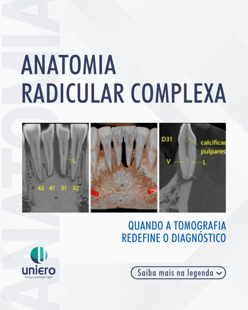 anatomia-radicular-complexa