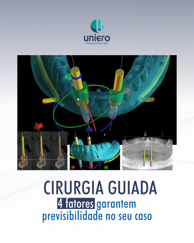 teoria-da-cirurgia-guiada