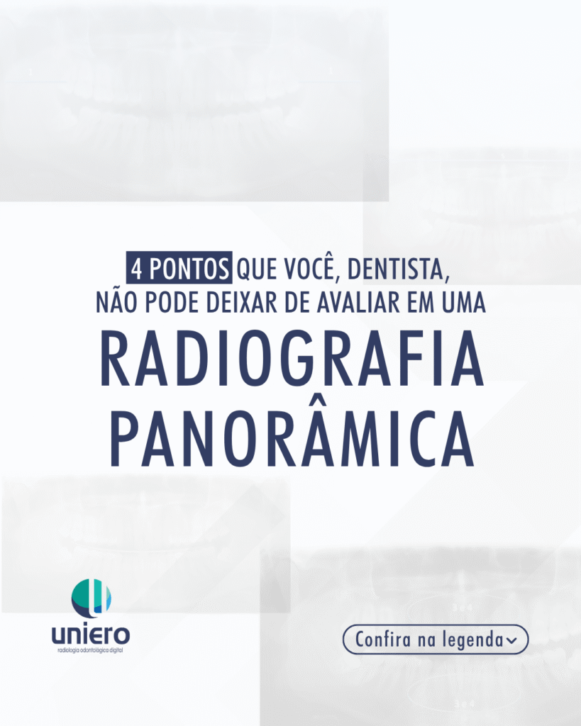 planejamento-com-radiografia-panoramica